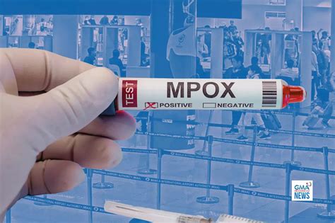 PH boosts airport screening amid mpox threat .